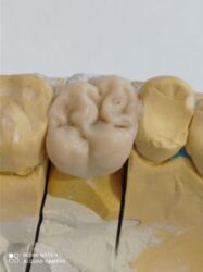 графика adobe illustrator cc: Обучение зубных техников металлокерамика восковое моделирование