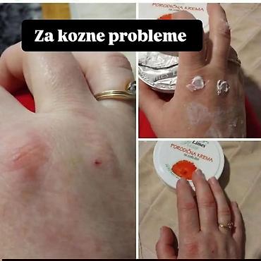 crni sup: Nemojte ići na plažu bez ove kreme 🤗 🌿 PORODIČNA KREMA – melem koji — 5