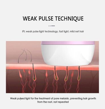 Lazer epilyatorları: Lazer epilyatoru, İşlənmiş, Ünvandan götürmə — 5