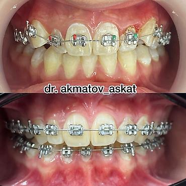 Медицинские услуги: Врачи | Стоматолог | Консультация — 4