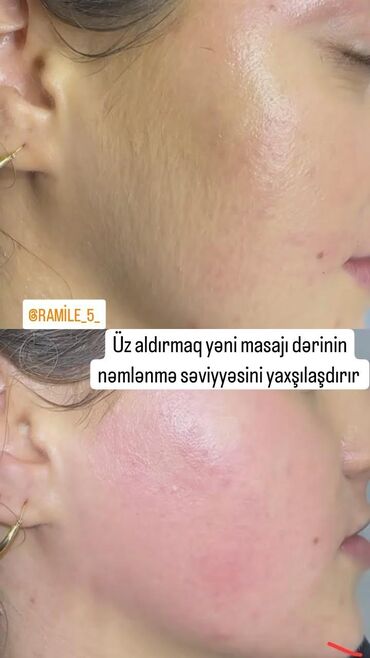 Kirpiklər, qaşlar: Xidmət: Üz aldırmaq və nəmləndirici masaj Təsvir: - Yüz nahiyəsindəki
