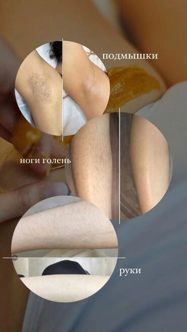 Эпиляция: Шугаринг (депиляция сахарной пастой) Зоны: - Подмышки - Ноги (голени) — 2