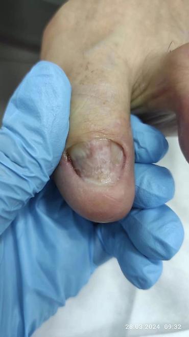 Маникюр: Ремонт сломаных ногтей, Наращивание ногтей, Донаращивание ногтей, Услуги подолога, Маникюр, Педикюр, Консультация, Одноразовые расходные материалы — 6