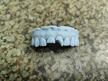 стоматологический аппарат: 3D‑печать учебных стоматологических моделей на заказ - Печатаем — 2