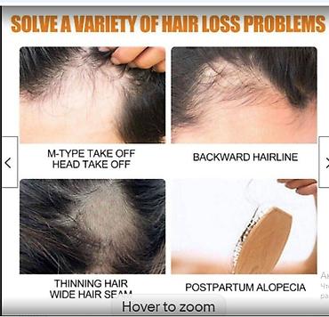 фильер: От Выпадения волос облысения США Minoxidil Оригинал прямые поставки — 5