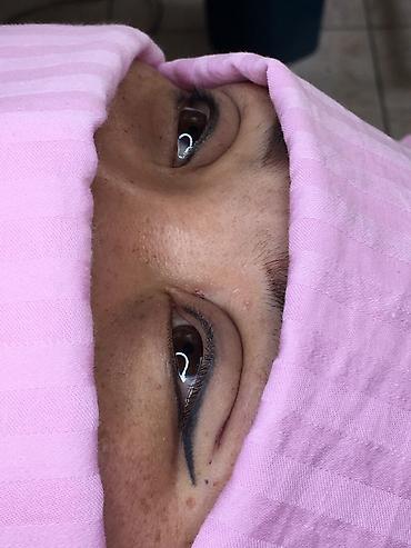 Косметология: Косметология, Ботокс, Биоревитализация, Ботулинотерапия, С выездом на дом, Консультация, Гипоаллергенные материалы — 4