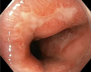 Другие услуги: ЭГДС. Гастроскопия . ФКС. +ТЮБАЖ. Осмотр желудка, кишечника. Врач — 3