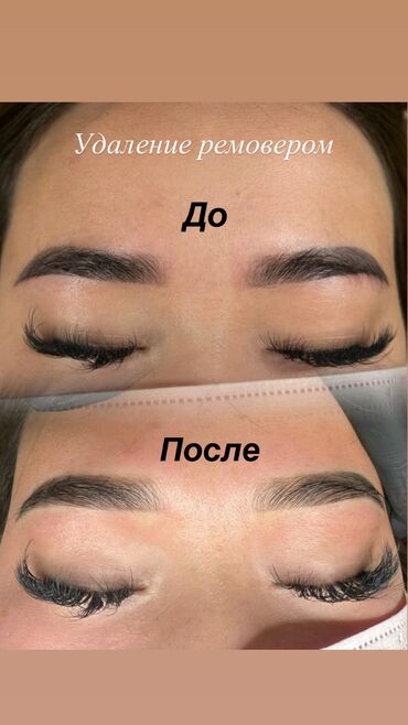 Перманентный макияж: АКЦИЯ !АКЦИЯ! Новый метод удаления Сейчас по акции Лазерное удаление — 10