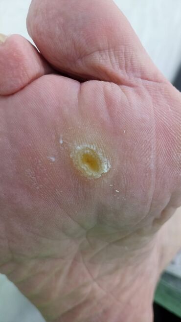 Маникюр, педикюр: Коррекция вросших ногтей, Маникюр, Педикюр, Услуги подолога, Консультация, Одноразовые расходные материалы — 13