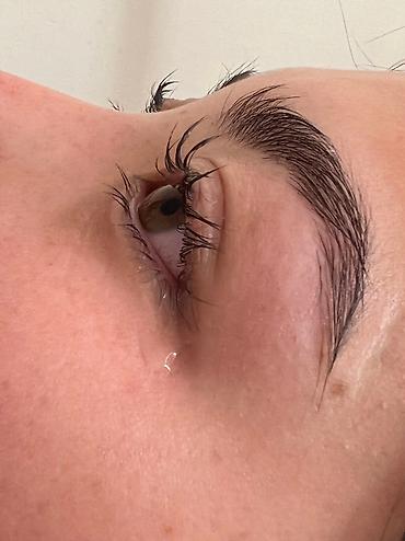 Косметология: Косметология, Ботокс, Биоревитализация, Ботулинотерапия, Консультация, Гипоаллергенные материалы, Сертифицированный косметолог at lalafo.kg — 30 Косметология: Косметология, Ботокс, Биоревитализация, Ботулинотерапия, Консультация, Гипоаллергенные материалы, Сертифицированный косметолог — 30