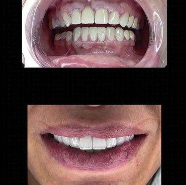 Stomatologiya: 💫Ramazan ayı ilə əlaqədar Kampaniya✨🌟⭐💫 🌊🔥Diş Həkimi 🔥🌊 Qiymətləri — 11