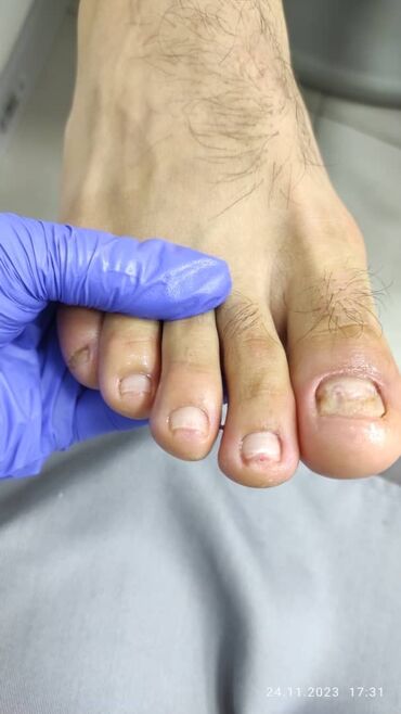 Маникюр, педикюр: Наращивание ногтей, Гель лак, шеллак, Укрепление ногтей, Услуги подолога, Маникюр, Педикюр, Консультация, Одноразовые расходные материалы — 10