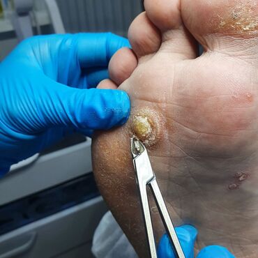 Маникюр, педикюр: Коррекция вросших ногтей, Маникюр, Педикюр, Услуги подолога, Консультация — 19