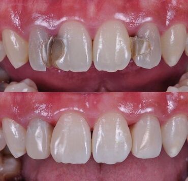 Стоматология: Стоматолог | Реставрация, Протезирование, Чистка зубов | Консультация