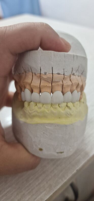 1 стоматология бишкек: Дарыгерлер, Клиника | Стоматолог | Протездөө