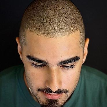 mühafizə xidməti: Tatto nökte atişiylariyla tük effekti yaradib keçelliyi örten — 3