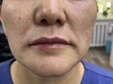 Косметология: Косметология, Маски, Мезотерапия, Удаление носогубных складок, Гипоаллергенные материалы, Консультация, Сертифицированный косметолог — 10