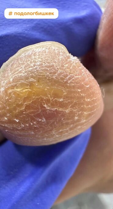 Маникюр, педикюр: Коррекция вросших ногтей, Педикюр, Услуги подолога, Консультация, Одноразовые расходные материалы — 3