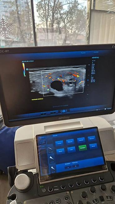 Медицинское оборудование: Продаётся УЗИ аппарат экспертного класса Mindray DC-80 X-INSIGHT — 12