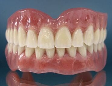 Другое: Зубные протезы,из нейлона пластмассыбюгельные протезыБеру слепки