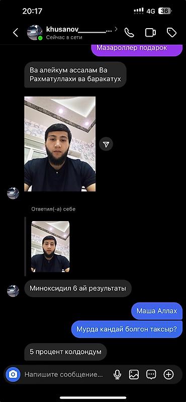 Уход за телом: Миноксидил ультра 15% 100мл 3 месяц хватает Для бороды и волосы — 10