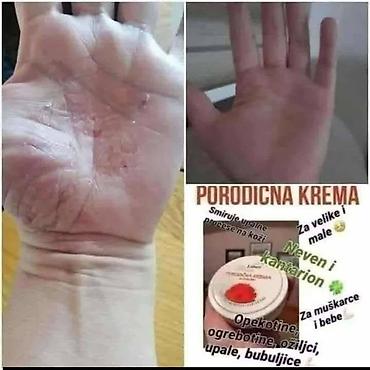 Nega kože: Ide leto,deca su u majicama i sorcicima. Padovi sa — 11