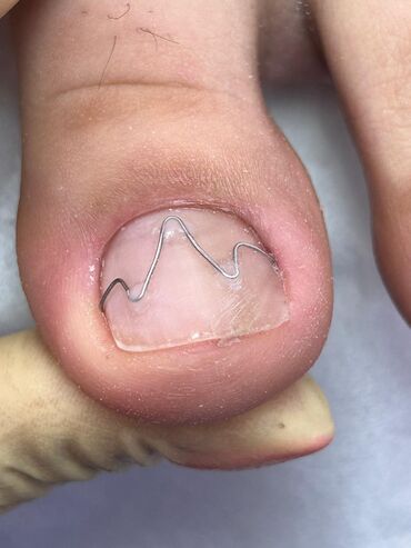 Маникюр, педикюр: Ремонт сломаных ногтей, Снятие, Укрепление ногтей, Услуги подолога, Одноразовые расходные материалы, Консультация, С выездом на дом — 4