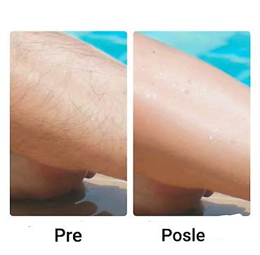 ove: KRISTALNI RUČNI EPILATOR ZA BEZBOLNO UKLANJANJE DLAKE SA CELOG — 5