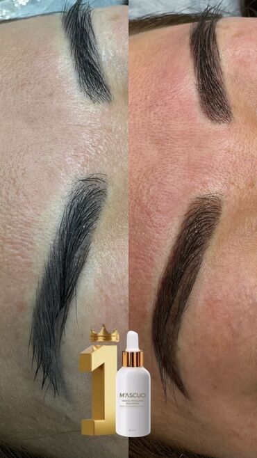 Перманентный макияж: АКЦИЯ !АКЦИЯ! Новый метод удаления Сейчас по акции Лазерное удаление — 13