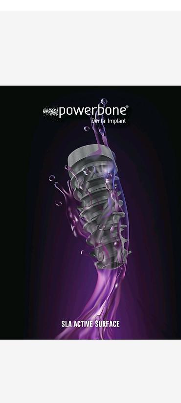 Digər tibbi məhsullar: Qiymətə abatmentdə daxildir. Powerbone Dental Implant – SLA Active — 1