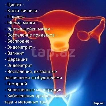 Gözəllik və sağlamlıq: Tampon Fohow - Terkibinde 40 növ ot var - soyuqlamanı kesir -epidermis — 2