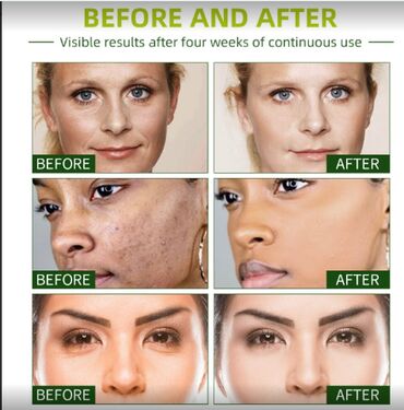 Уход за телом: США Крем антивозрастной отбеливающий увлажняющий питающий листаем фото — 14