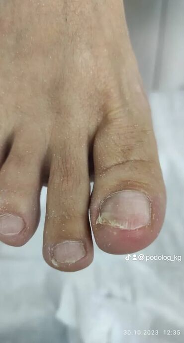 Маникюр, педикюр: Коррекция вросших ногтей, Выравнивание, Услуги подолога, Маникюр, Педикюр, С выездом на дом, Консультация, Одноразовые расходные материалы — 8