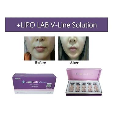 Lipo Lab V-Line Solution — инъекционный липолитик для коррекции