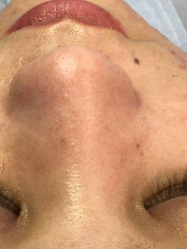 Косметология: Косметология, Брыли, Ботокс, Биоревитализация, Консультация, Гипоаллергенные материалы, Сертифицированный косметолог — 20