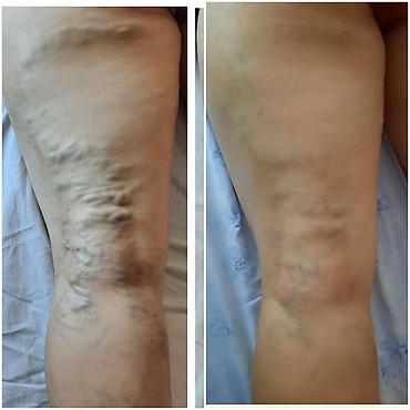 Витамины и БАДы: Питательные таблетки ГАОСЕН — натуральный продукт для поддержания — 7