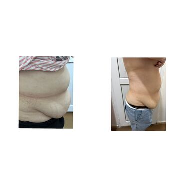 Hicama, zəli: Xidmət: Kupa terapiyası (quru və yaş/hicama), bel–boyun–çiyin masajı — 12