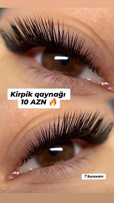 сколько стоят брекеты в баку: Kirpik qaynağı xidməti – 10 AZN Ünvan: Suraxanı - Təbii görünüşlü — 2