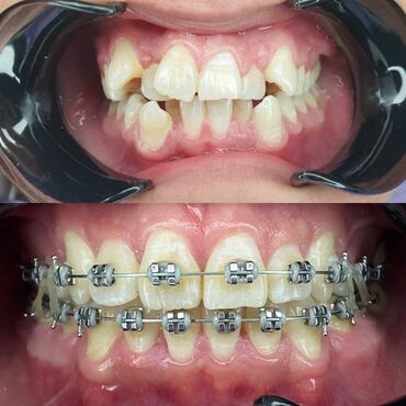 стоматологическая бормашина в Кыргызстан | МЕДИЦИНСКОЕ ОБОРУДОВАНИЕ: Стоматолог | Реставрация, Протезирование, Чистка зубов | Консультация, Круглосуточно