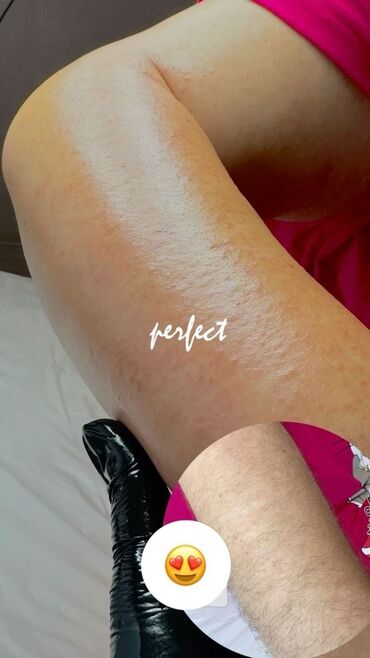 Красота, здоровье: Курсы | Мастера депиляции Предоставление расходного материала — 17