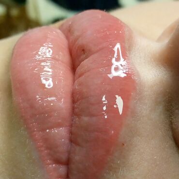 Косметология: Косметология, Биоревитализация, Ботулинотерапия, Контурное моделирование, Гипоаллергенные материалы, Консультация, Сертифицированный косметолог — 29