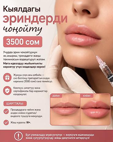 Косметология, Увеличение губ, Требуются модели