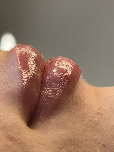 Косметология: Косметология, Маски, Мезотерапия, Удаление носогубных складок, Гипоаллергенные материалы, Консультация, Сертифицированный косметолог — 53