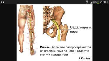 массаж тина: Массаж | Дарылоочу | Остеохондроз, Омуртка аралык грыжа, Протрузия | Үйүнө баруу менен, Консультация