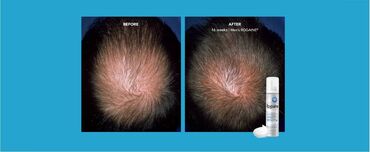 Saçlara qulluq: Saç maskası, Hər növ saçlar üçün, Yeni, Ünvandan götürmə, Pulsuz çatdırılma, Ödənişli çatdırılma — 13