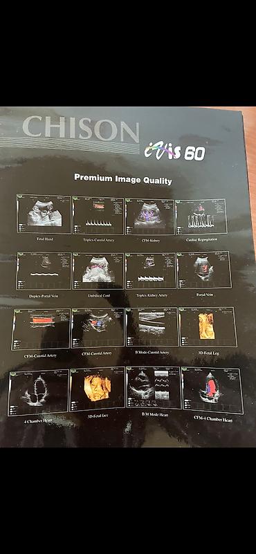 Медицинское оборудование: Продается Узи аппарат
Г.Ош
8.000 at lalafo.kg — 11 Медицинское оборудование: Продается Узи аппарат
Г.Ош
8.000 — 11