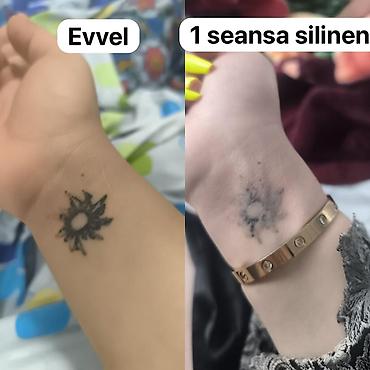 doyme sekilleri: Tatunuzun seklin gonderin qiymet deyilsin🤗3 seansa kimi lyuboy seansda — 1