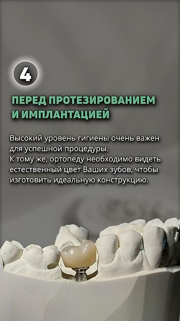 стоматологический апарат: Профессиональная гигиена полости рта и профилактический осмотр у — 5