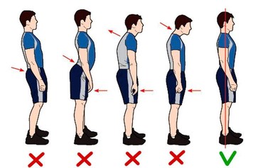 Медицинские услуги: Осанка, выпрямление осанки. современный метод лечения. без