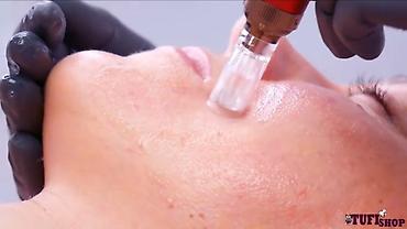 Косметология: Косметология, Брыли, Ботокс, Биоревитализация, Консультация, Гипоаллергенные материалы, Сертифицированный косметолог — 6